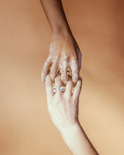 Anello Abbraccio - ErnestoShop Concept Store